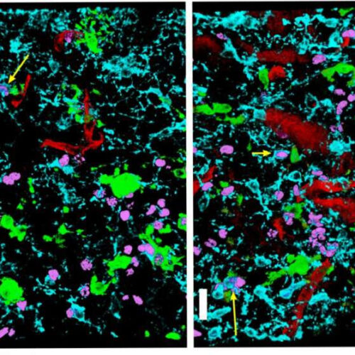 Repairing nerves requires prods of protein