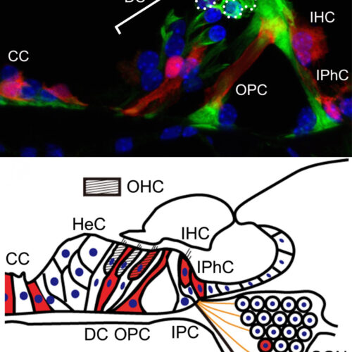 Superoxide produced in the cochlea of inner ears causes acquired hearing loss