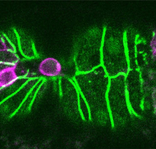 Biologists discover a trigger for cell extrusion