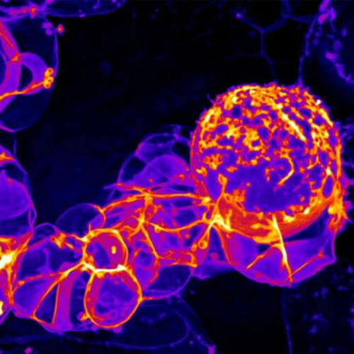 Researchers find cell division machinery that makes brain cells