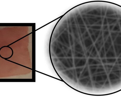 Implantable piezoelectric polymer improves controlled release of drugs