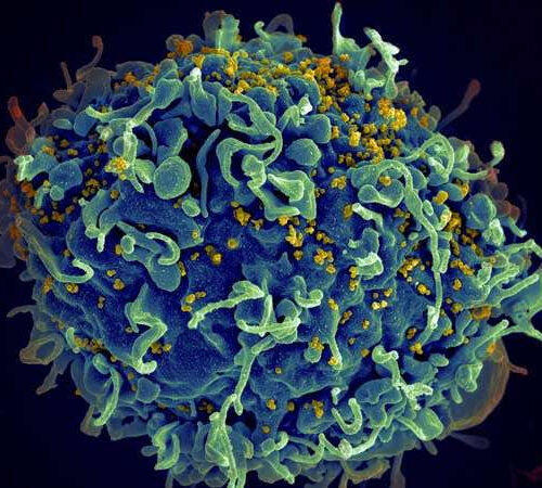 A trait of the rare few whose bodies naturally control HIV: ‘Trained’ immune cells