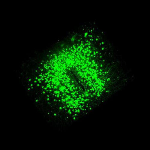 Same nerve cell, different influence on food intake