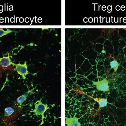 Novel immunotherapy boosts long-term stroke recovery in mice