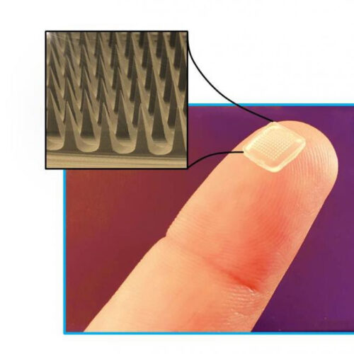 Microneedles are promising devices for painless drug delivery with minimal side effects