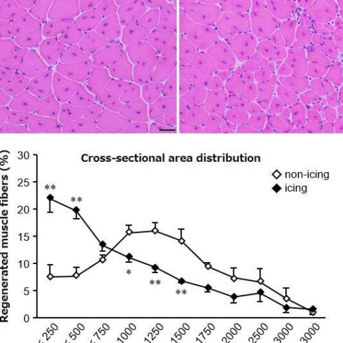 Icing muscle injuries may delay recovery