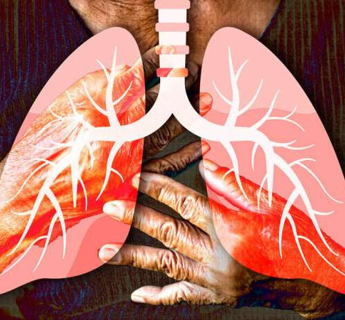 Researchers create cellular blueprint of healthy lungs