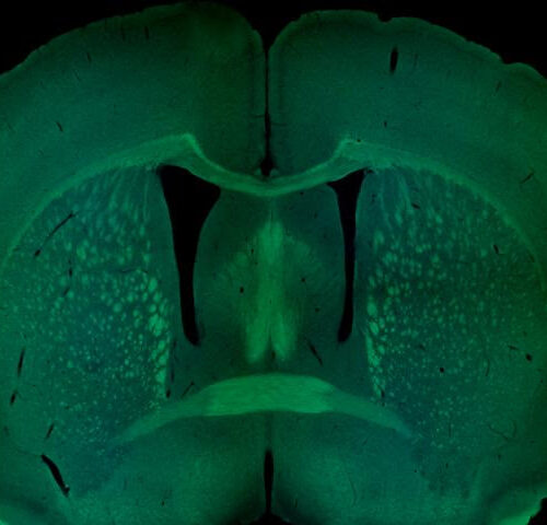 Sex-specific genetics of autism