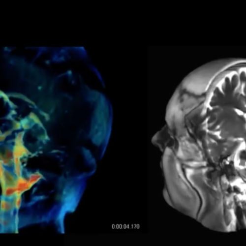 New imaging tech offers incredibly detailed 3D videos of pulsating brains