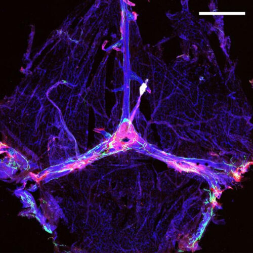 Brain’s waste removal system may offer path to better outcomes in Alzheimer’s therapy