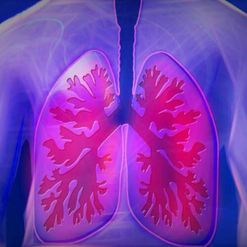 Nanotechnology could make a huge difference in treating a lung infection often associated with COVID-19 ventilation