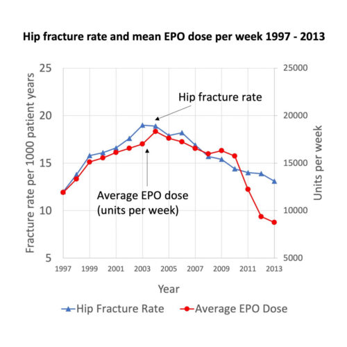 Erythropoietin treatments may increase hip fracture risk in patients with kidney failure