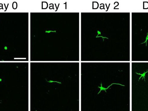 Oleoyl-LPE exerts neurite stimulation and neuroprotection