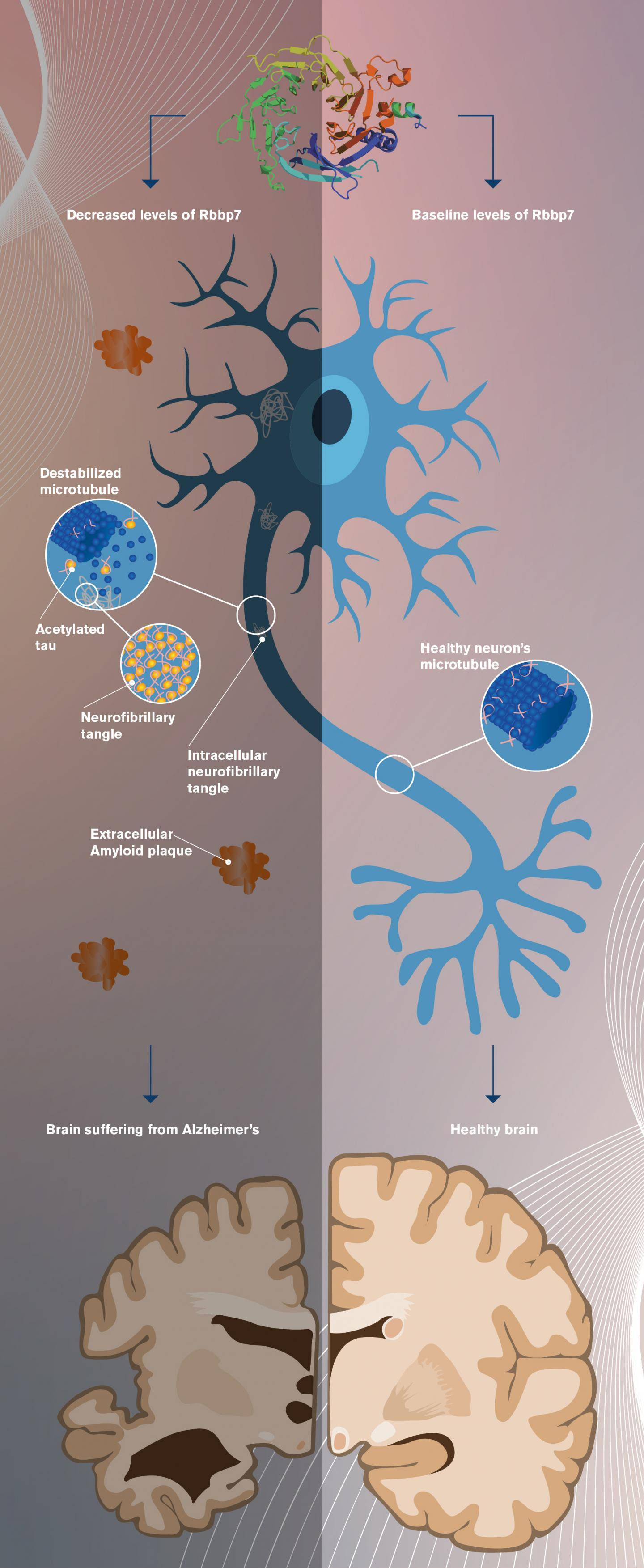 Untangling the brain: new research offers hope for Alzheimer’s disease