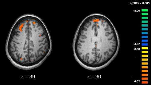 Commonly used anticholinergic drugs for schizophrenia linked to greater cognitive impairment