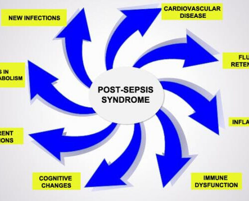 Phenomenon explains why patients who survive sepsis die sooner after hospital discharge