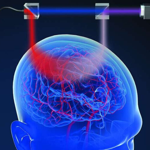 Measuring brain blood flow and activity with light