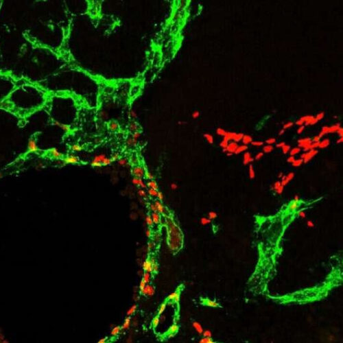 Mitochondria play key role in lymphatic development