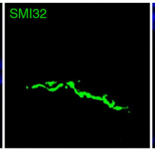 Chronic attack on the aging nervous system