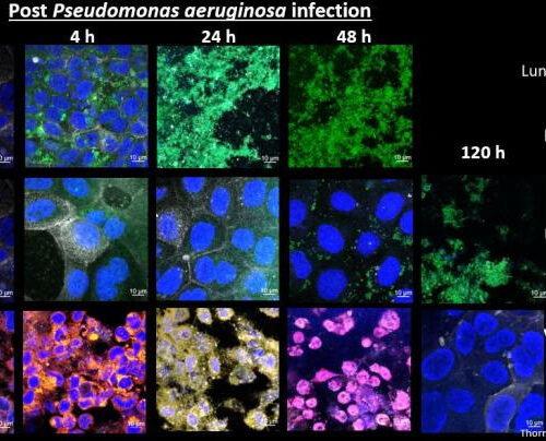 Novel nanotech improves cystic fibrosis antibiotic by 100,000-fold