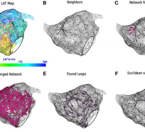 Scientists created technology to detect and treat complex arrhythmias