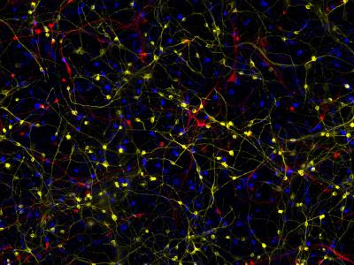 Salk scientists reveal how brain cells in Alzheimer’s go awry, lose their identity