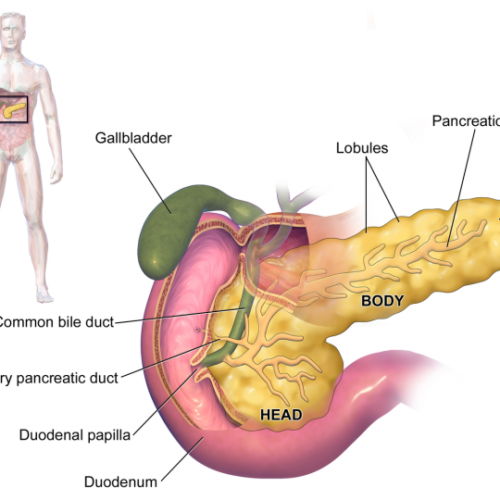 Cholesterol-carrying protein found to help suppress immune response in pancreatic tumor microenvironment