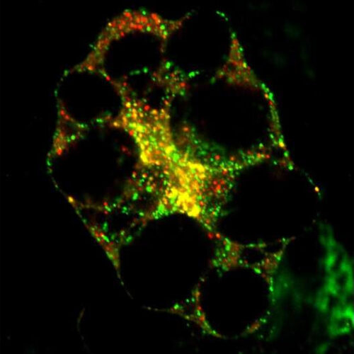 Enhanced autophagy could help treat diabetes