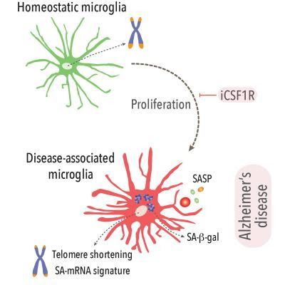 Scientists discover immune cell behavior that plays a key role in Alzheimer’s disease