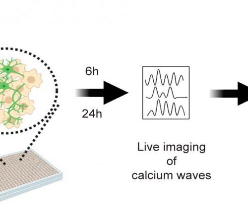 Motor neurons derived from patients point to new possible drug target for ALS