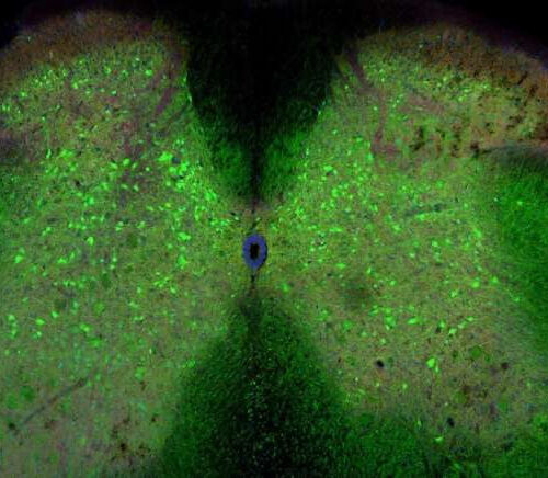 ALS development could be triggered by loss of network connections in the spinal cord