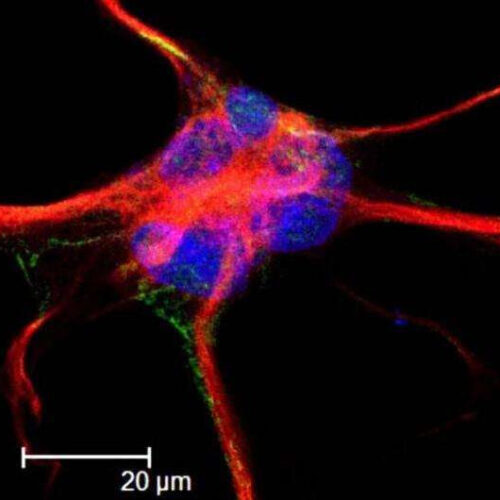 Researchers find the adhesions that build the brain’s networks