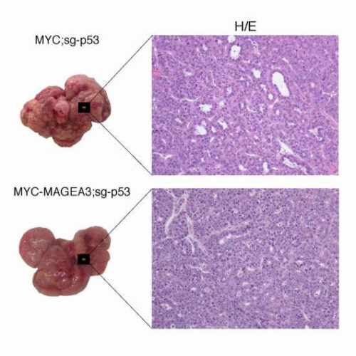 Genetic study of liver cancer reveals new drug target