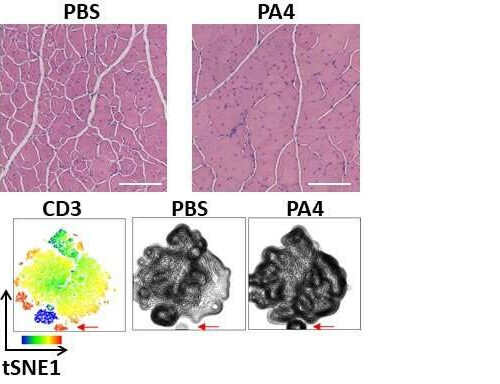 Muscling up with nanoparticle-based anti-inflammatory therapy