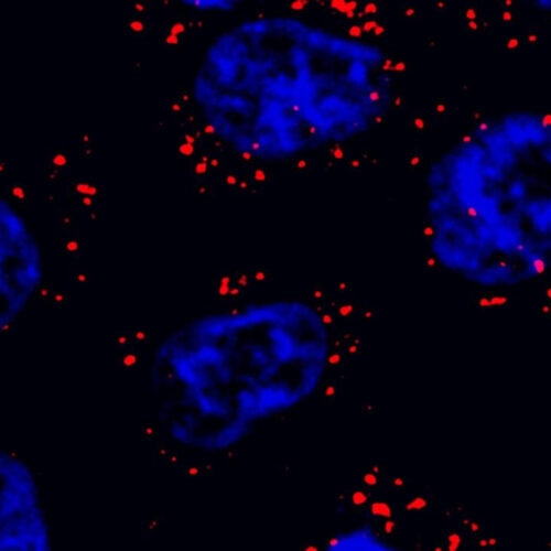 “phase separation” allows an RNA to tightly control the activity of a protein that regulates neurodegeneration and aging