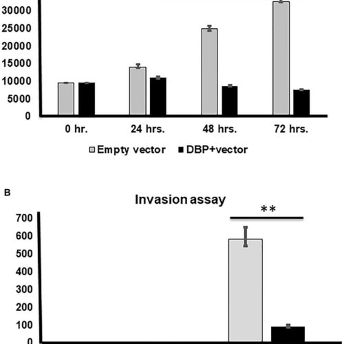 Filipino-Americans: Vitamin D binding protein in thyroid cancer health disparities