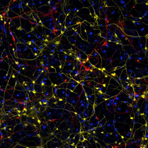 Salk scientists reveal how brain cells in Alzheimer’s go awry, lose their identity