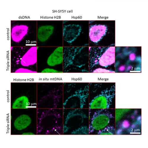 New study gives clue to the cause, and possible treatment of Parkinson’s Disease