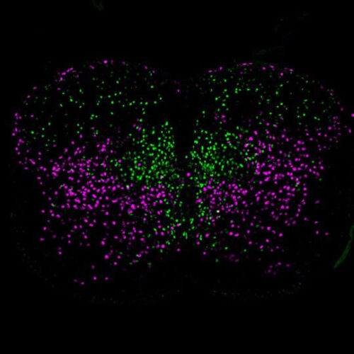 Researchers trace spinal neuron family tree