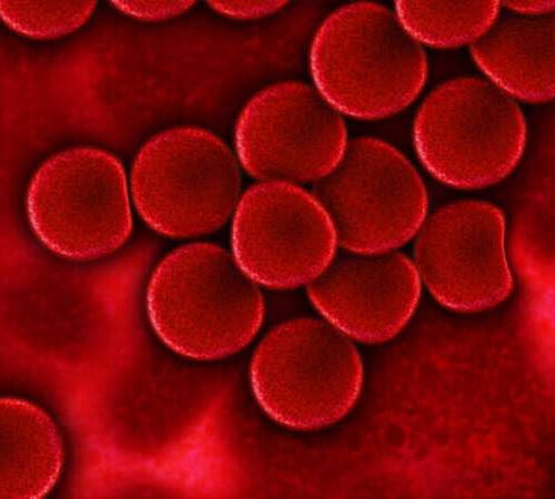 Gene therapy more cost effective than current treatments for hemophilia B