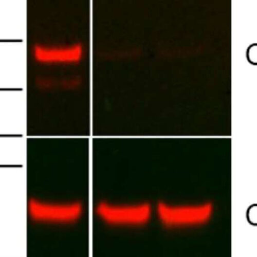 Antibody targets mechanism that enables lung cancer to grow and spread