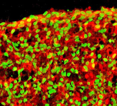 Research advances one step closer to stem cell therapy for type 1 diabetes