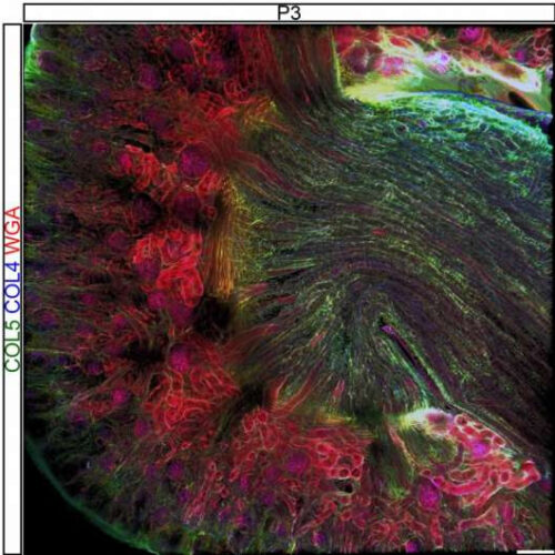 Research paves way for new kidney treatment, potential synthetic transplant options