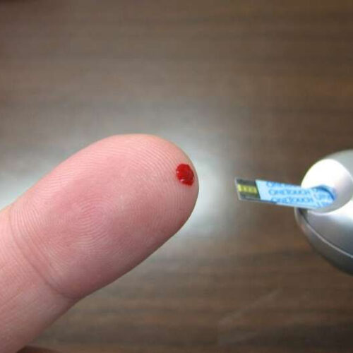 Major study of diabetes trends shows Americans’ blood sugar control is getting worse