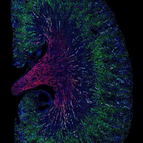 The same cell type can help or hinder kidney repair after acute injury