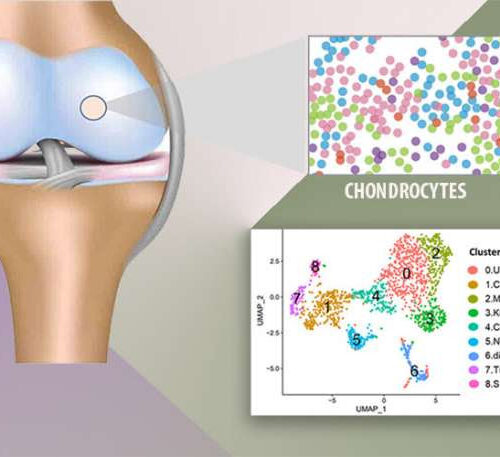 New research identifies injury-induced molecular changes in chondrocytes, at single-cell level