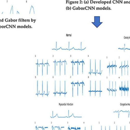 New artificial intelligence tool could speed up diagnosis of cardiovascular diseases