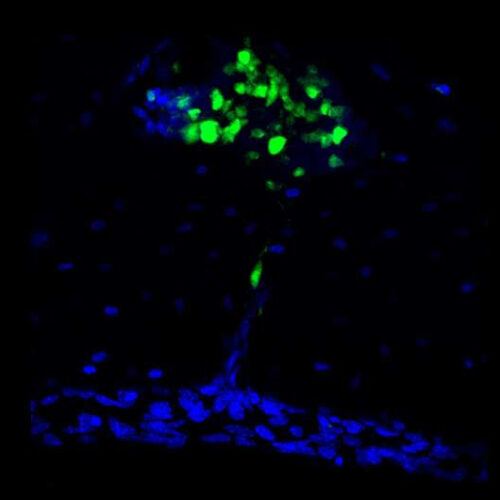 Studies reveal skull as unexpected source of brain immunity