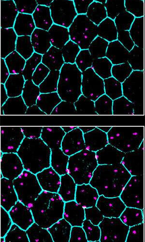 Recycling of the eye’s light sensors is faulty in progressive blindness of older adults