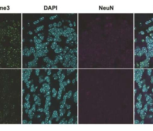 SUV39H2: A direct genetic link to autism spectrum disorders